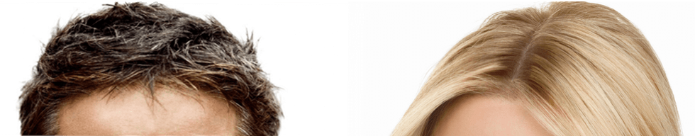 top-of-heads top-of-heads